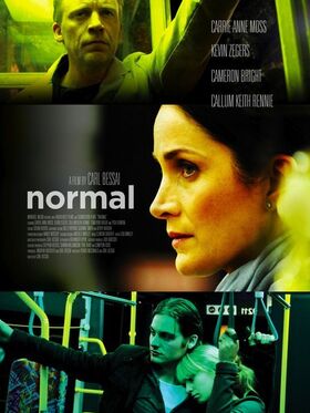 Normal